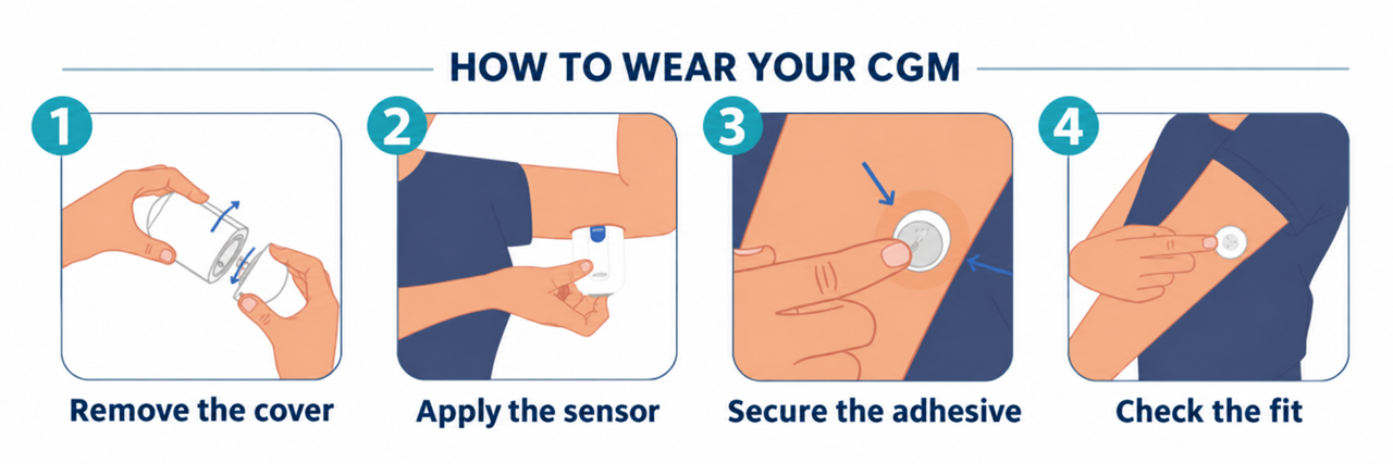 4 Steps to Apply Your CGM